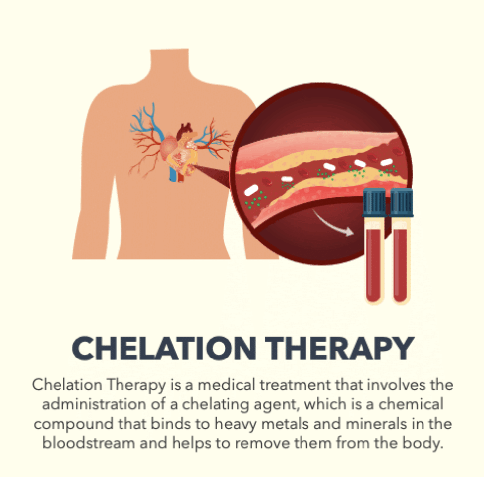 Chelation IV therapy